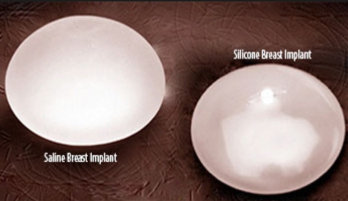 implantes salinos o de silicona: diferencias