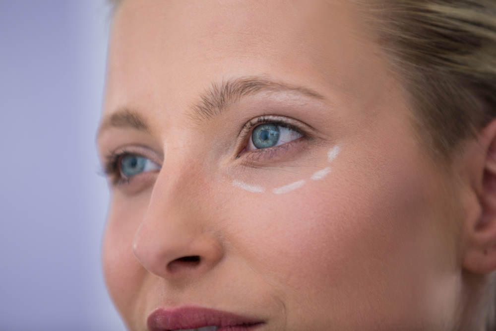 blepharoplasty